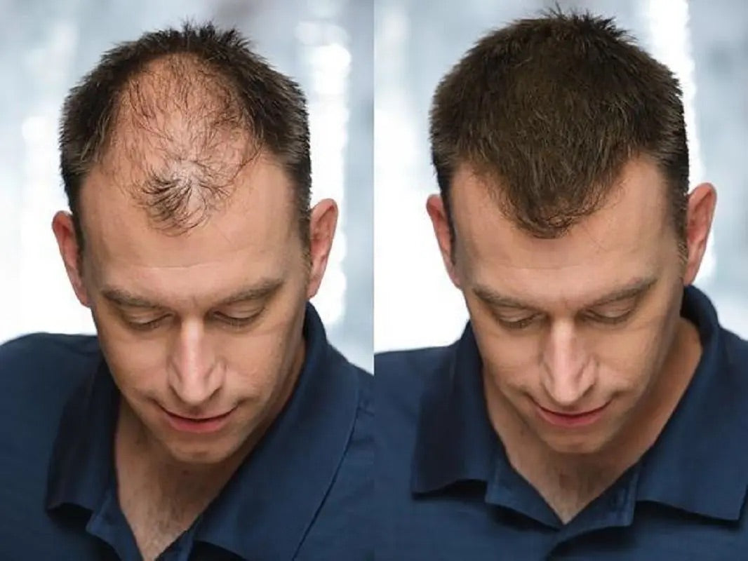 Fibra capilar Buny®