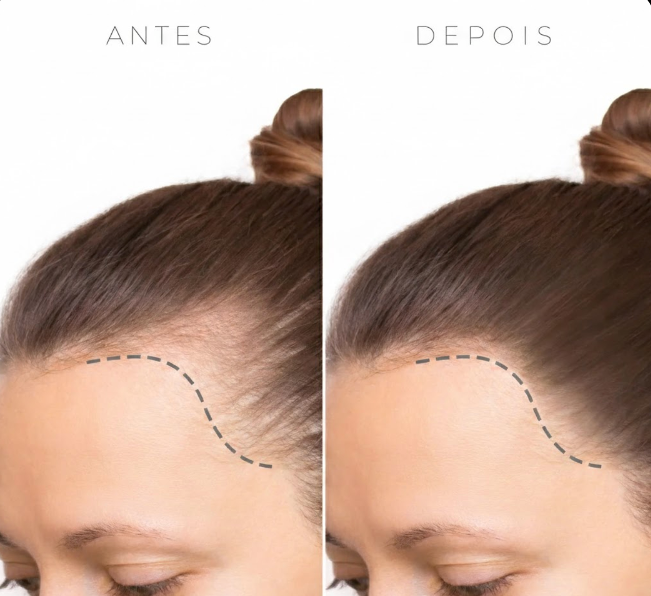 Fibra capilar Buny®